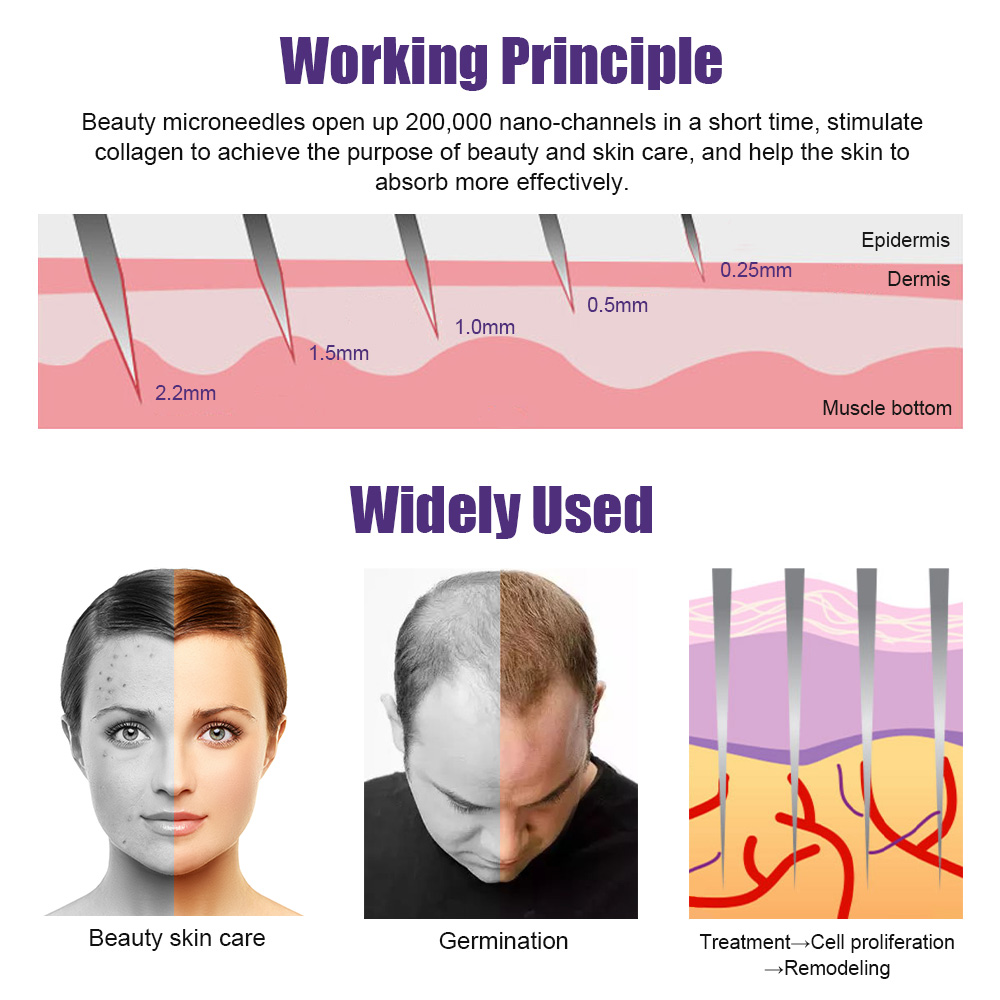 Natural Men Beard Growth Derma - Derma Roller 0.25 评论和价格