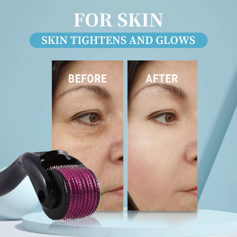 Professional 540 Roller Derma  - Derma Roller 0.25 评论和价格