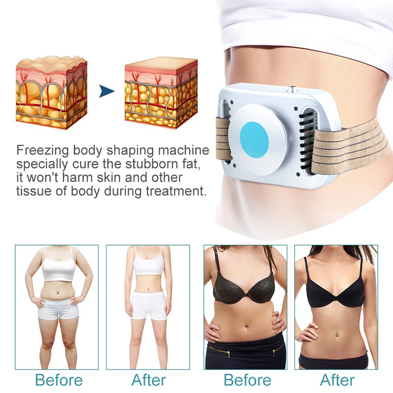 NEW Fat Freeze Body Slimming M - Spa And Wellness 评论和价格