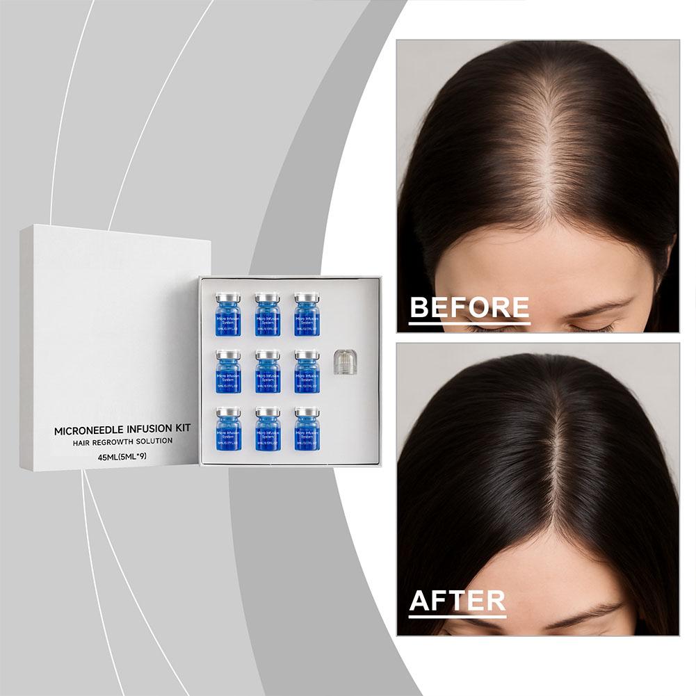 0.25mm Hair Essential Serum Mi - Derma Roller 0.25 评论和价格